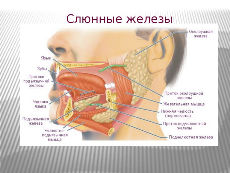 Причины и лечение плеоморфной аденомы околоушной слюнной железы