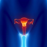 Фибромиома