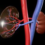 Липома почки